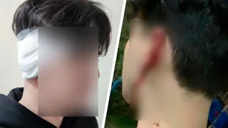 В Челябинской области задержали мужчину, откусившего ухо студенту